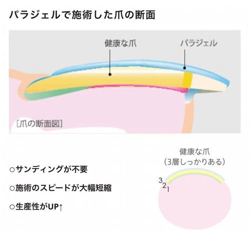 パラジェルで施術した爪の断面